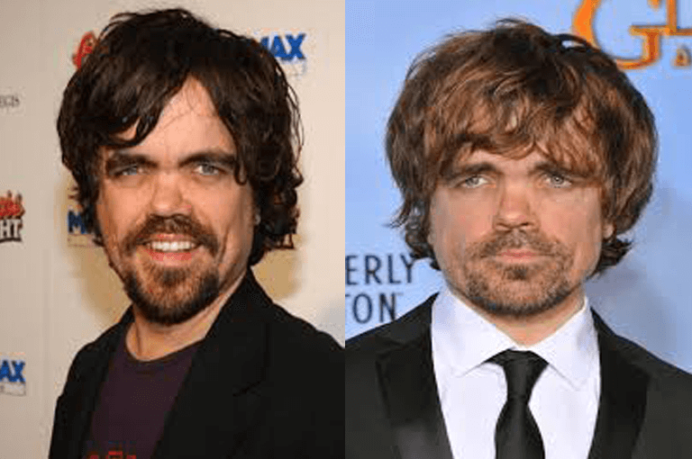 Peter Dinklage